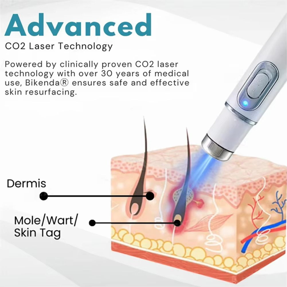 Non-Invasive Remover Pen – Professional Device for Face & Body, Gentle for All Skin Types Remover Tool Kit, Blemish Extractor Set